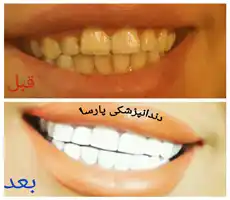 دندانپزشکی پارسا ارائه خدمات توسط دندانپزشکان مجرب با مواد درجه یک وبا کیفیت