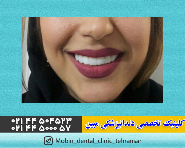 کلینیک دندانپزشکی مبین در تهرانسر