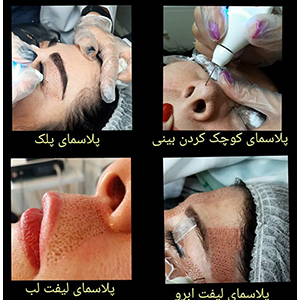 مرکز پوست و مو  قاصدک زعفرانیه در  زعفرانیه - محمودیه